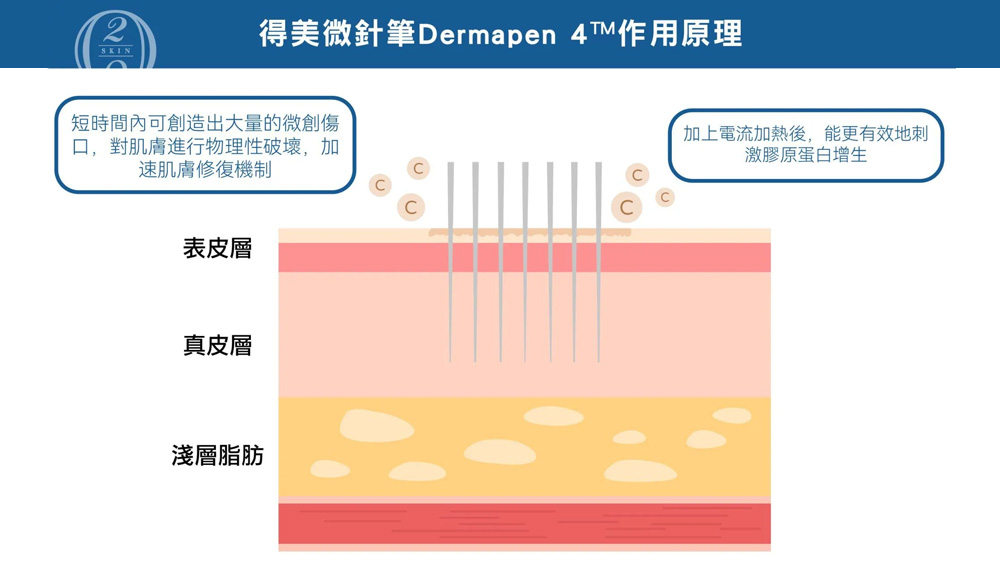 得美微針筆的三層作用機制