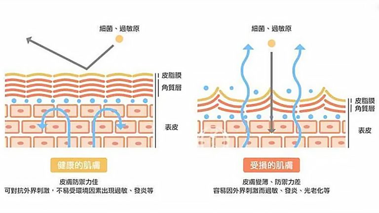 皮膚屏障是什麼