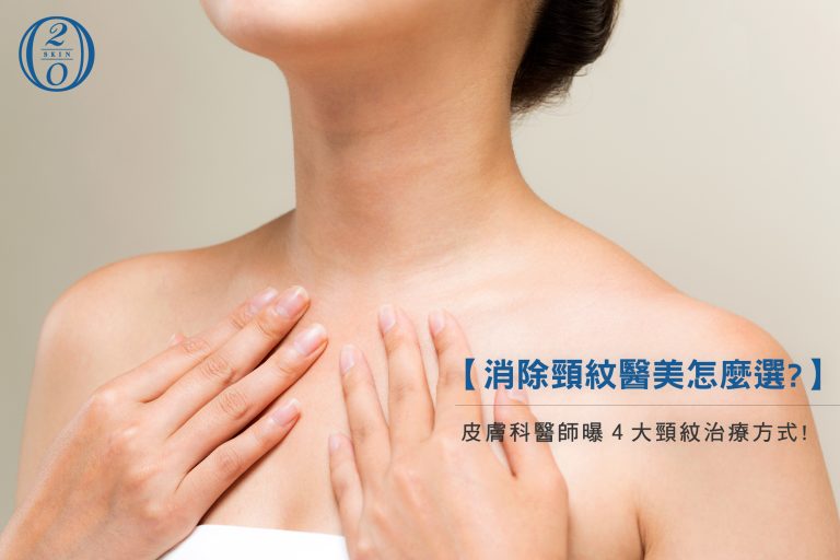 專業醫師解析:消除頸紋四大療程,帶你選對適合方案 消除頸紋醫美怎麼選?頸紋雷射有效嗎?皮膚科醫師曝4大頸紋治療方式!