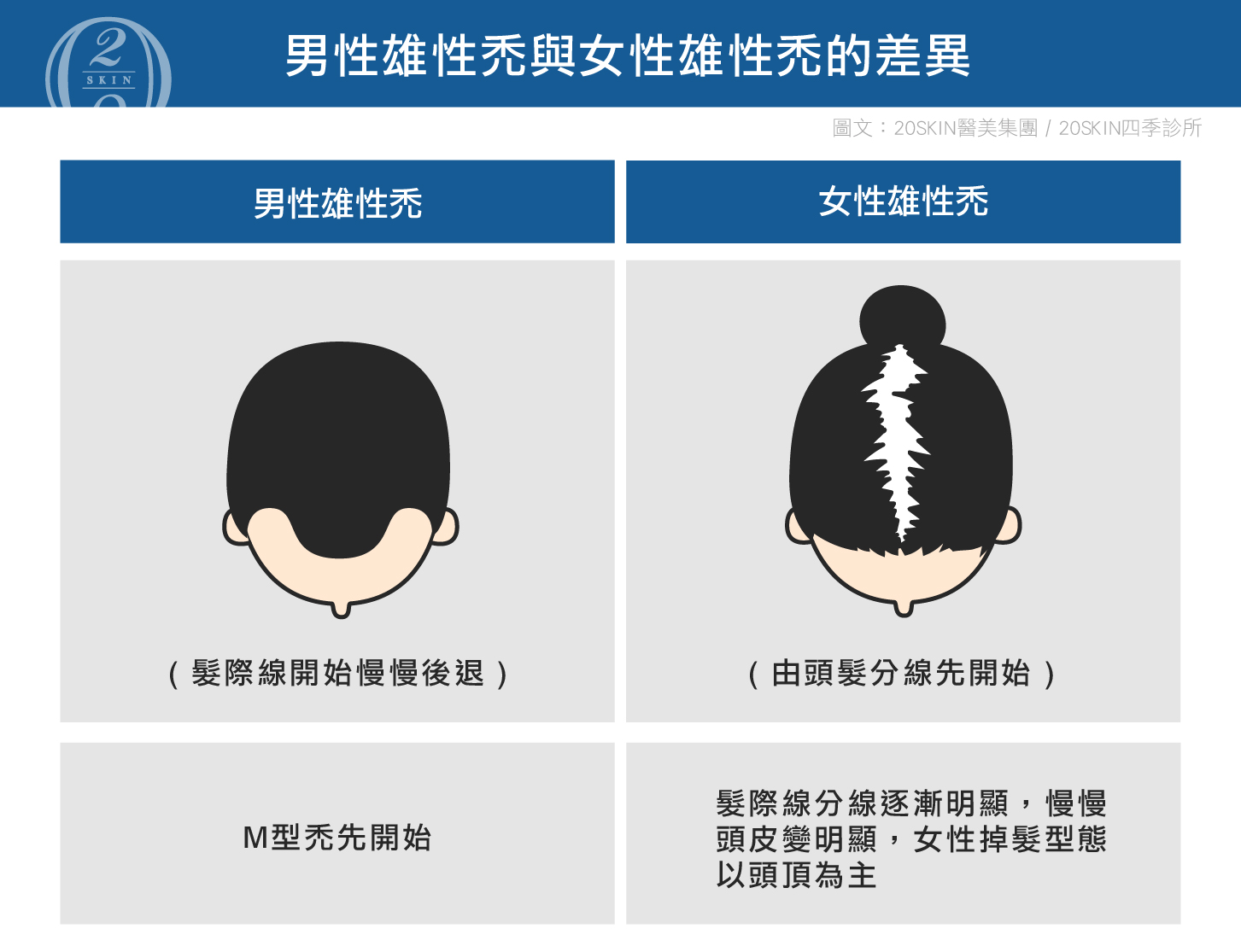 台中/二林四季皮膚科 - 雄性禿女性也會得到嗎?女性雄性禿治療該如何?