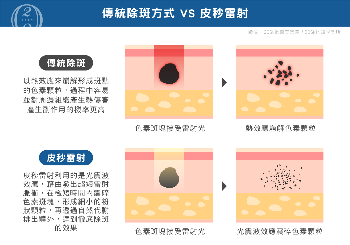 傳統除斑方式與皮秒雷射除斑方式製圖比較