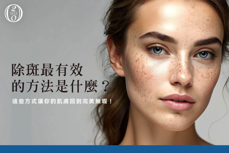 除斑最有效的方法是什麼?這些方式讓你的肌膚回到完美無瑕!