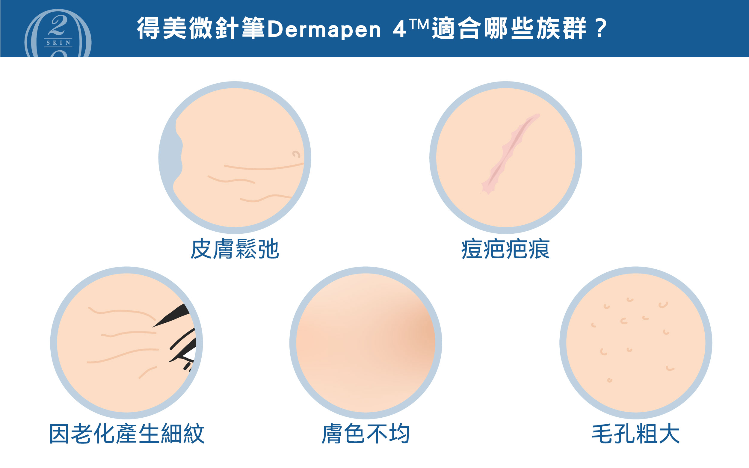 得美微針筆 Dermapen 4™ 適用於肌膚鬆弛、痘疤疤痕、毛孔粗大、膚色不均及細紋等問題族群
