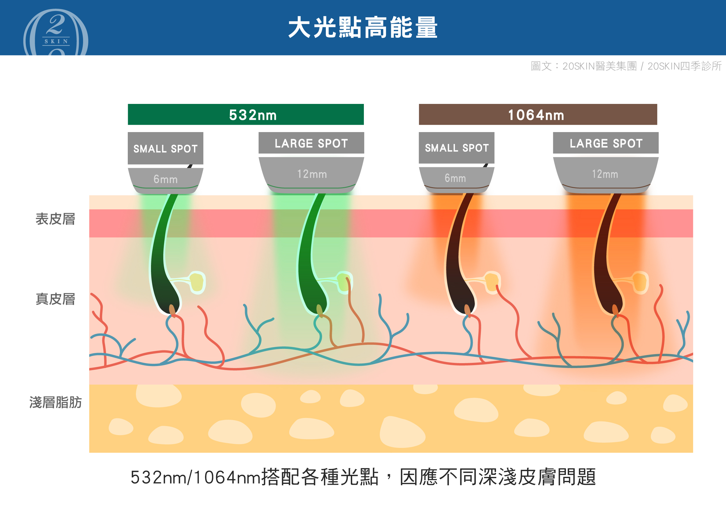 青萃光DermaV搭載532nm與1064nm雙波長，結合大小光點技術，針對不同深度的皮膚問題提供精準治療。高能量輸出可有效改善紅血絲、酒糟肌與色素沉澱，同時降低熱傷害，提升治療安全性與效果。