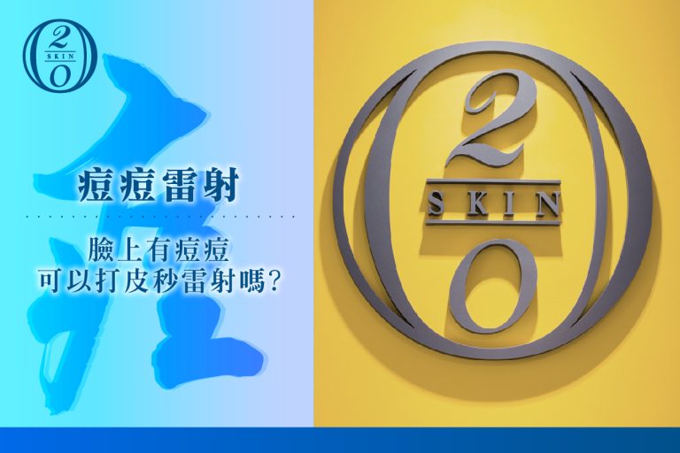 【青春痘雷射】臉上有痘痘可以打皮秒雷射嗎?
