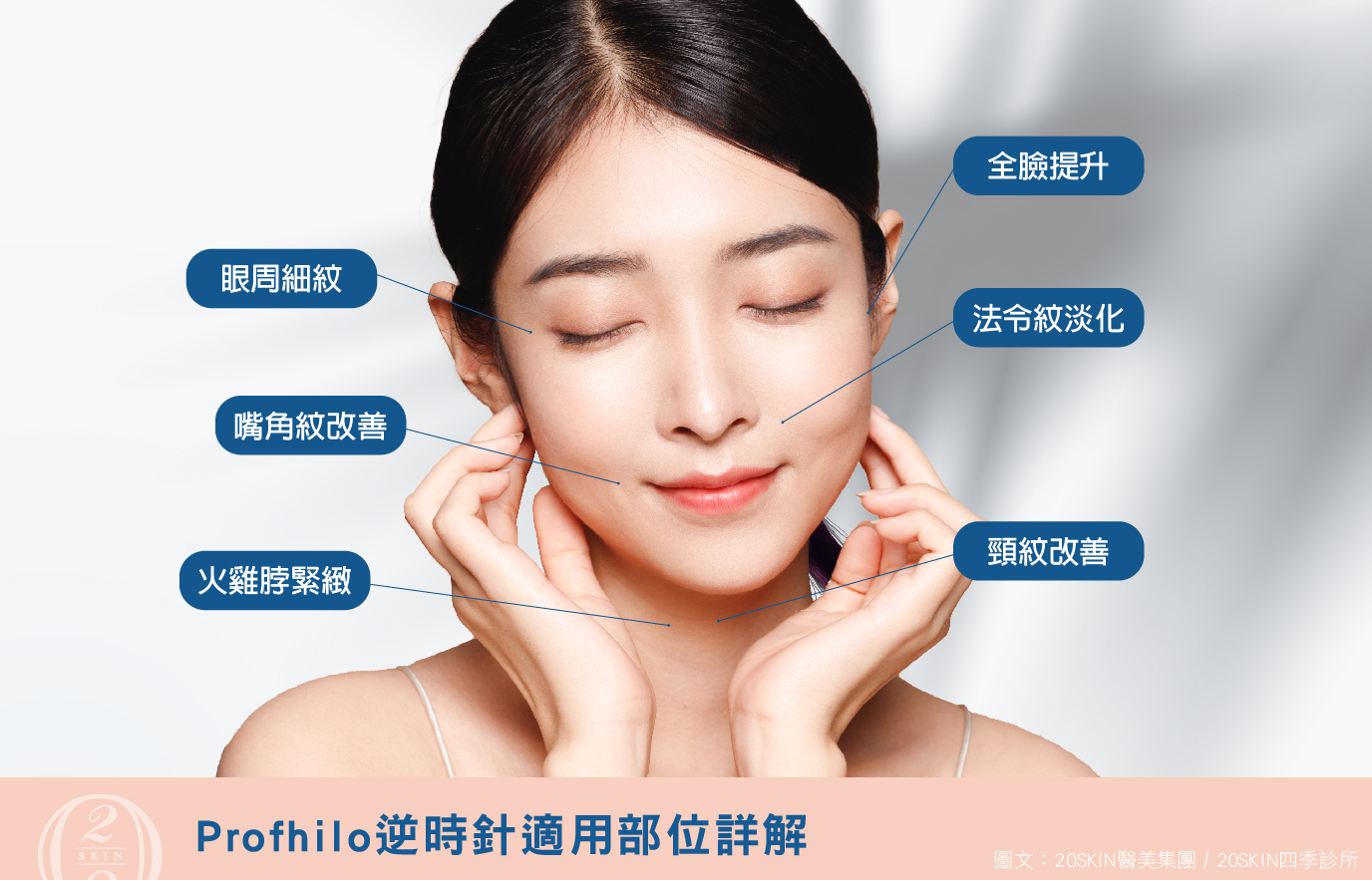 Profhilo逆時針適用部位