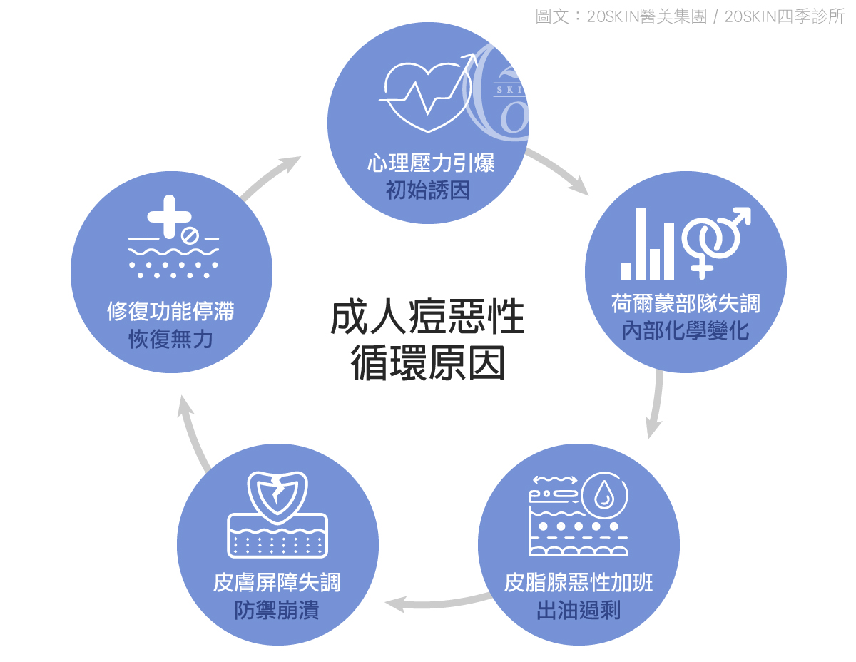 成人痘惡性循環原因