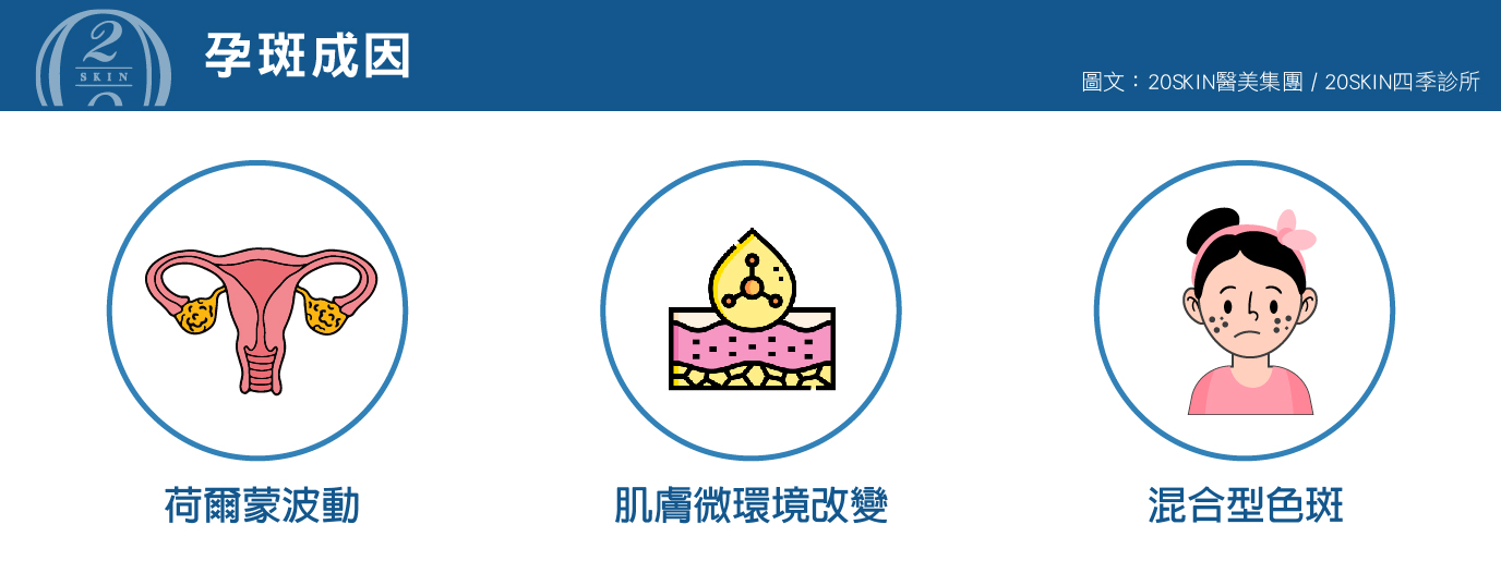 四季診所製圖說明孕斑成因
