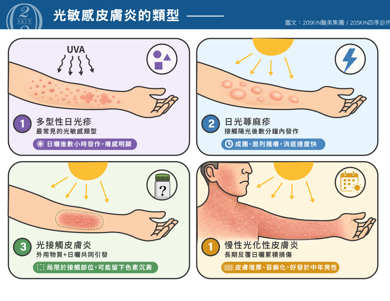 光敏感皮膚炎