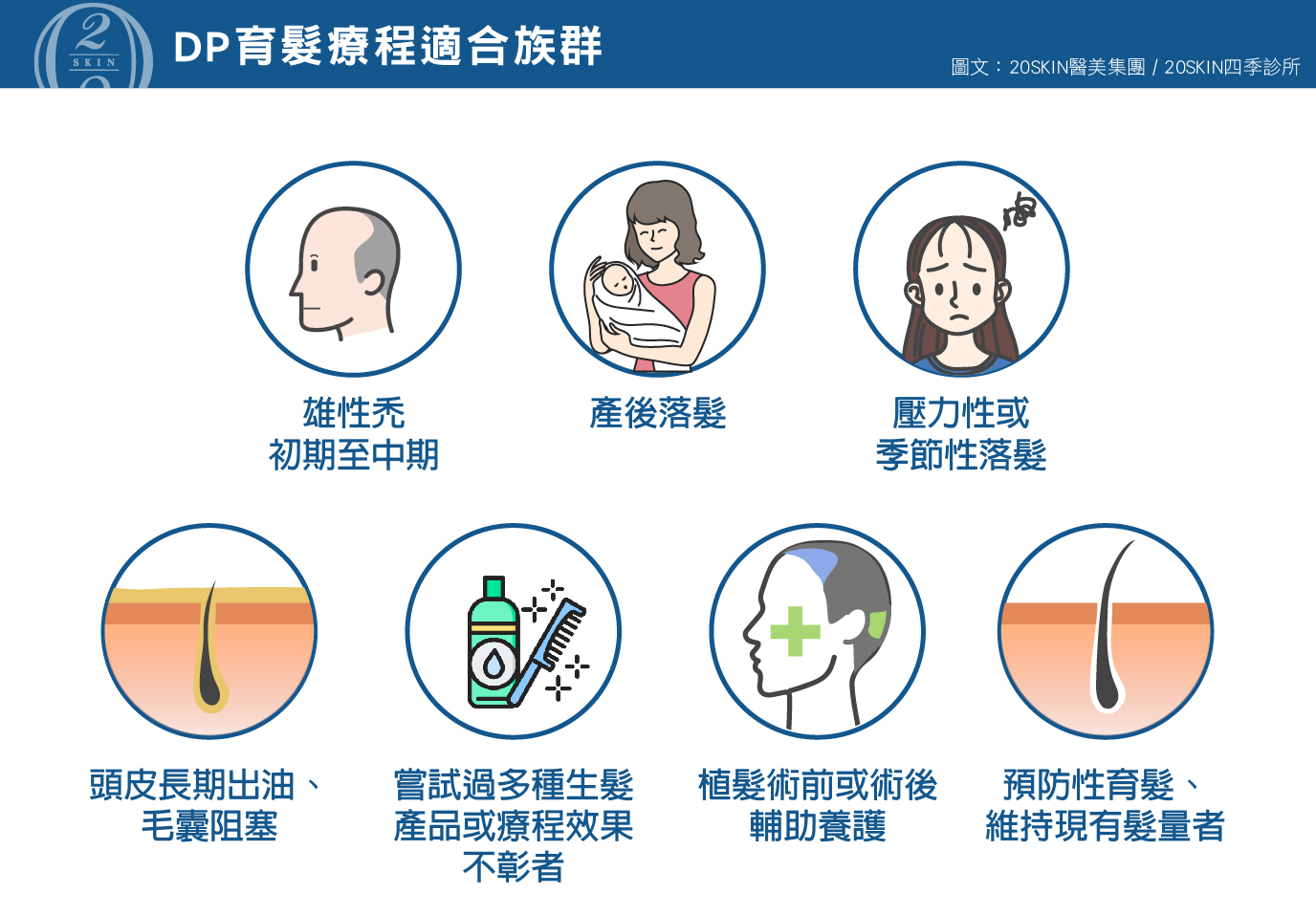 DP育髮療程適合的族群 