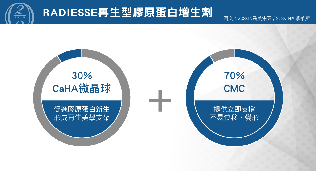 Radiesse再生型膠原蛋白增生劑
