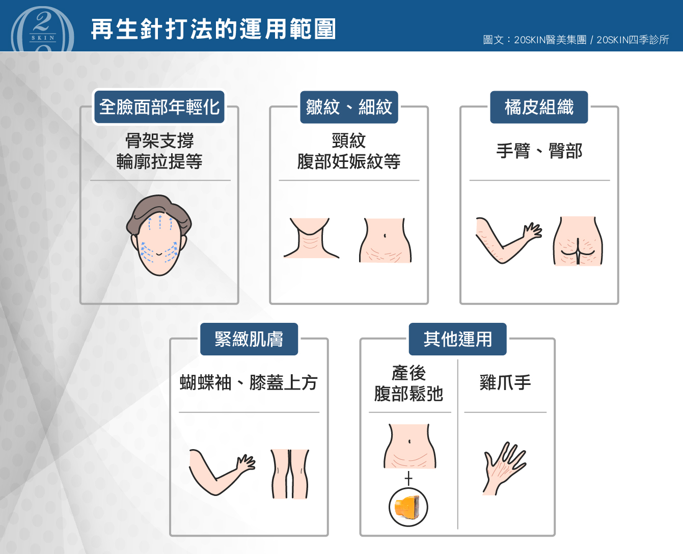 再生針打法的運用範圍