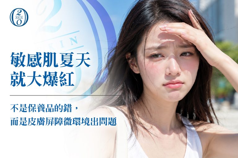 敏感肌夏天就大爆紅，不是保養品的錯，而是皮膚屏障微環境出問題