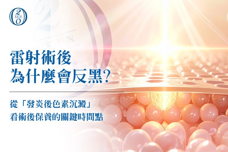 雷射術後為什麼會反黑?從「發炎後色素沉澱」看術後保養的關鍵時間點 雷射術後為什麼會反黑?從「發炎後色素沉澱」看術後保養的關鍵時間點