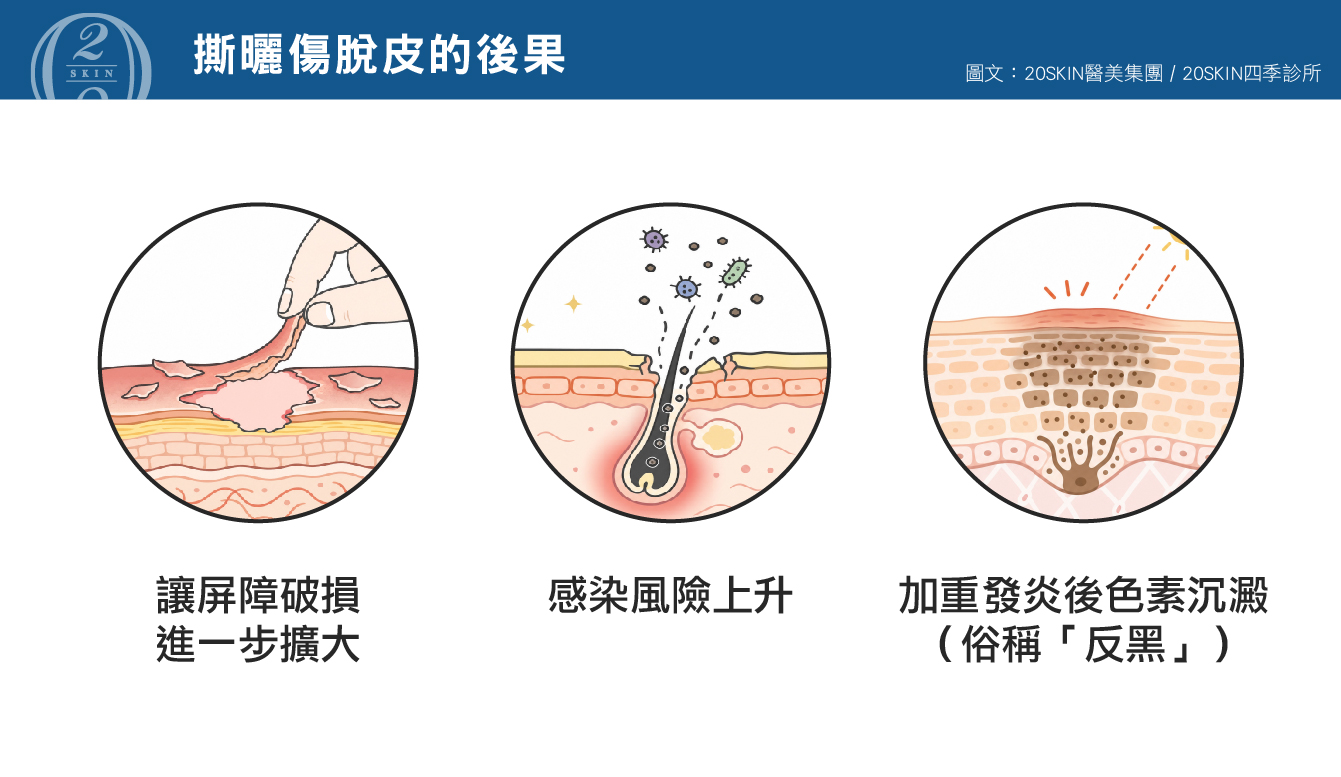 斯骰傷脫皮的後果