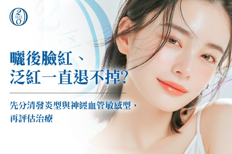 曬後臉紅、泛紅一直退不掉？先分清發炎型與神經血管敏感型，再評估治療