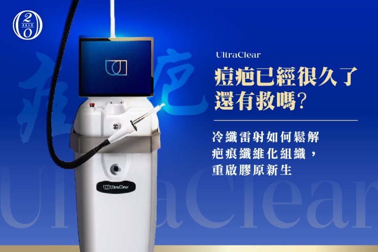 痘疤已經很久了還有救嗎?冷纖雷射如何鬆解疤痕纖維化組織,重啟膠原新生 痘疤已經很久了還有救嗎?冷纖雷射如何鬆解疤痕纖維化組織,重啟膠原新生