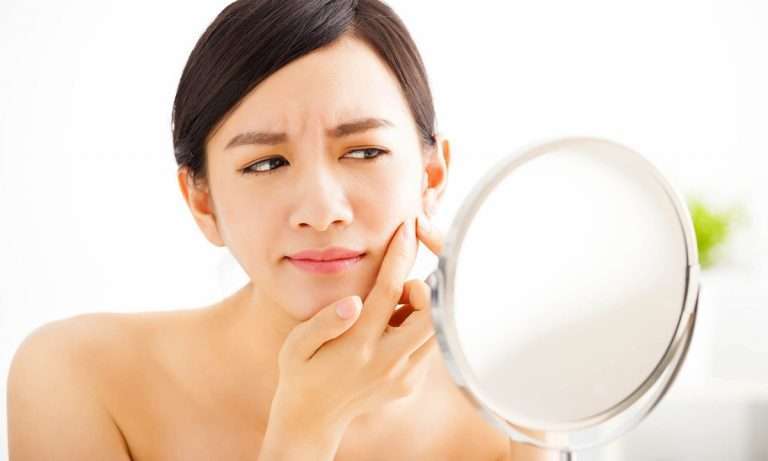 青春期時約有超過85％以上的人都具有青春痘的困擾