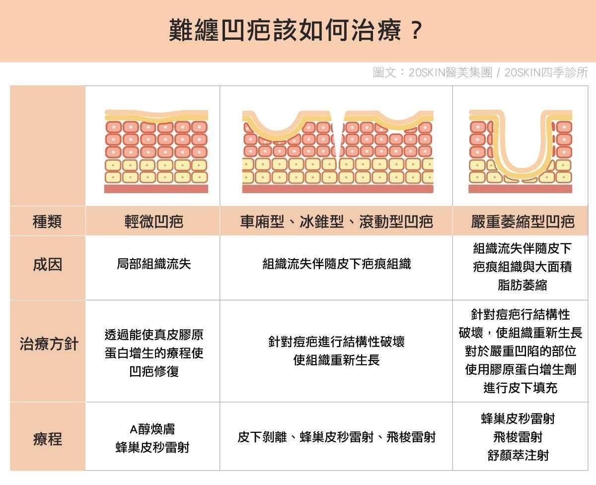 台中凹疤治療攻略！輕微至嚴重凹洞修復方案全解析台中四季皮膚科提供專業凹疤治療，針對輕微、車廂型、冰錐型與嚴重萎縮型凹疤，透過蜂巢皮秒雷射、飛梭雷射、舒顏萃注射等療程，促進膠原蛋白新生，修復肌膚組織，改善痘疤凹洞問題，恢復平滑細緻肌膚！