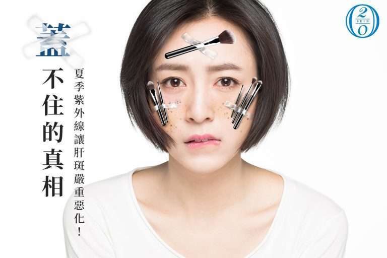 肝斑一直都是很多亞洲女性揮之不去的惡夢