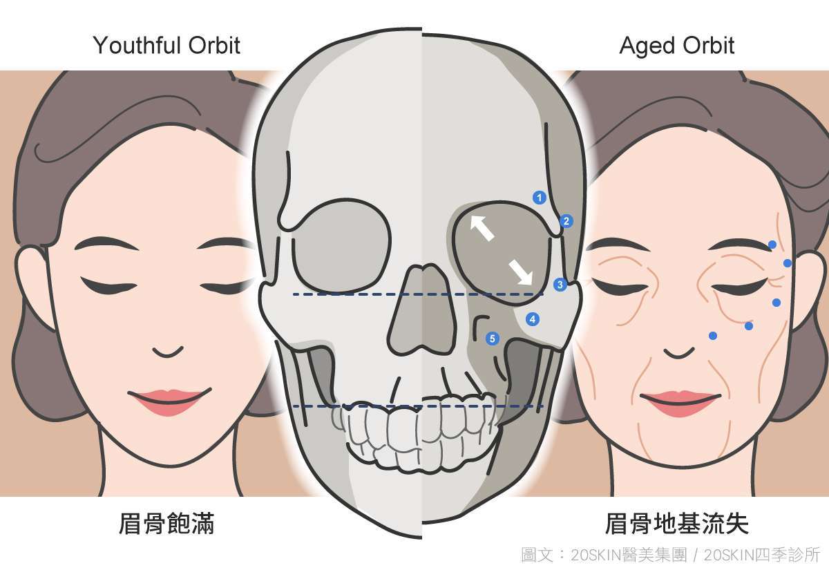 臉部骨架與老化關係