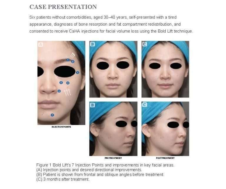 case