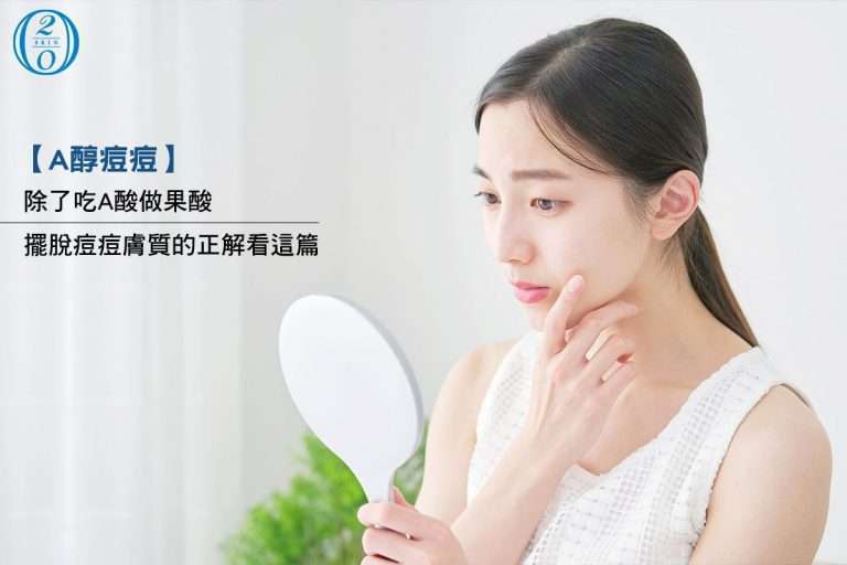 【A醇痘痘治療】除了吃A酸做果酸對抗痘痘肌,A醇痘痘治療更溫和有效?