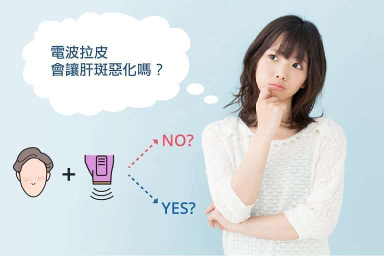 電波拉皮會讓肝斑惡化嗎