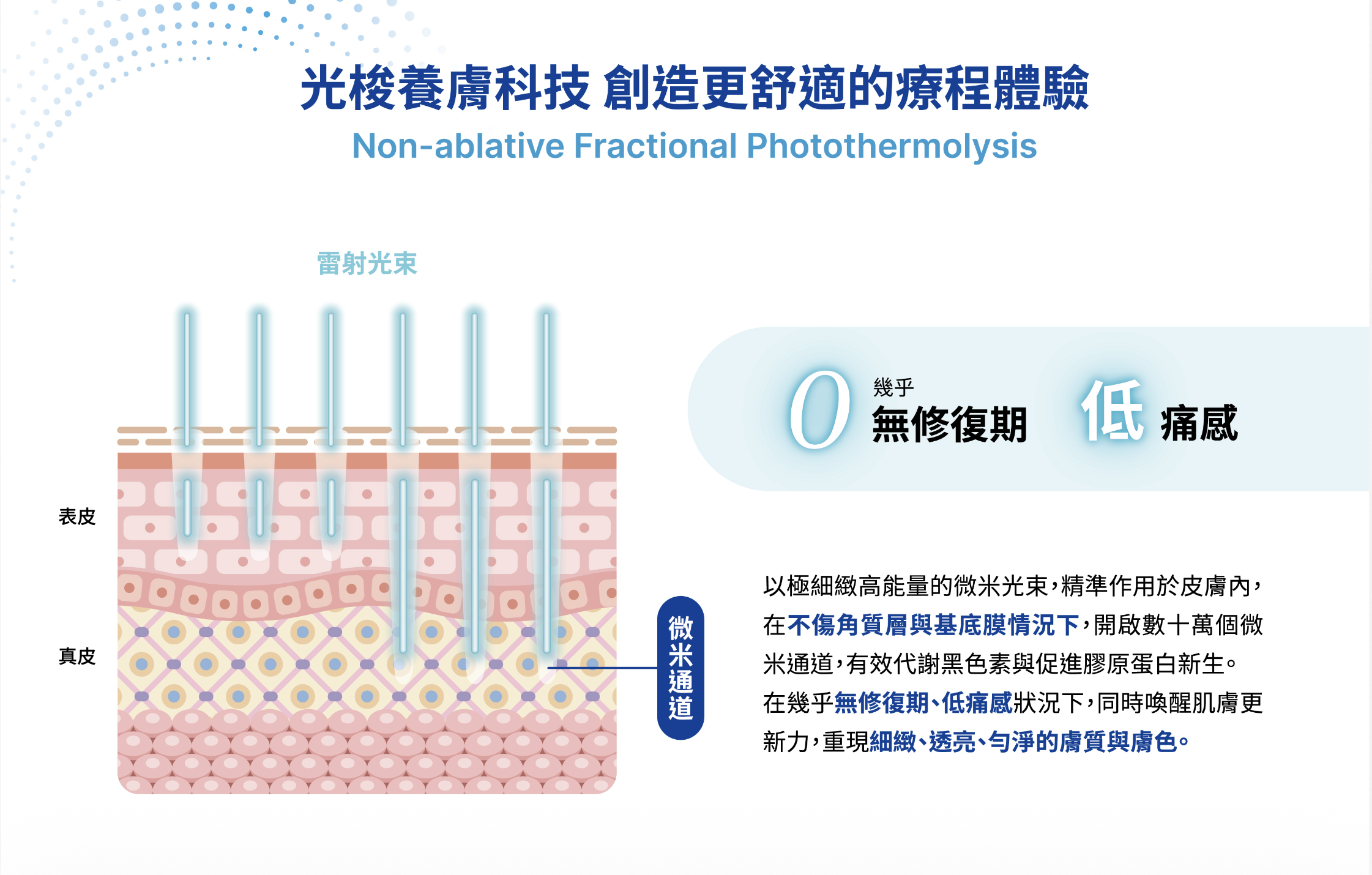 鳳凰光養膚是低痛感療程,能促進肌膚修復、維持穩定效果